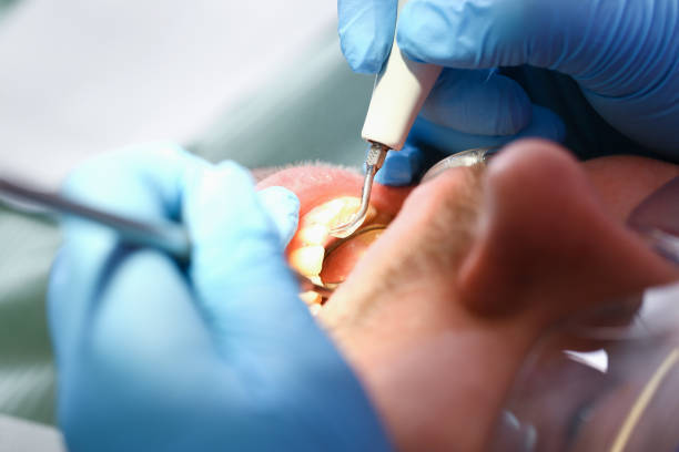Best Same-Day Emergency Dentist in Four Oaks, NC
